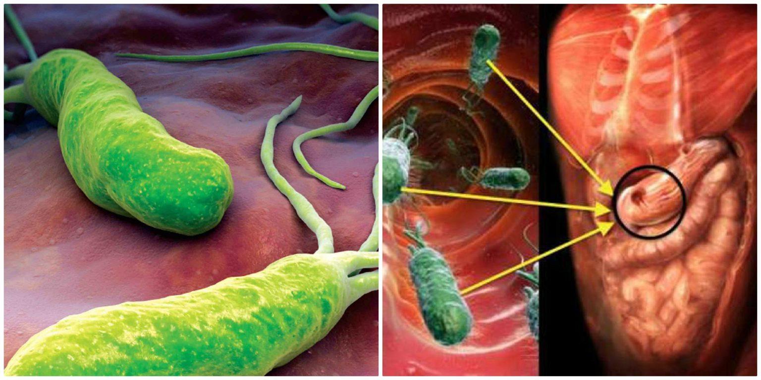Бактерия хеликобактер картинка